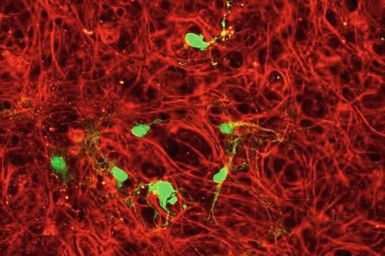 Immunzellen, die mit einem Typ von Adeno-assoziiertem Virus (AAV9) infiziert sind. Das Virus trägt genetisches Material, das die infizierten Mikroglia-Immunzellen im Gehirn dazu bringt, ein grün fluoreszierendes Protein zu produzieren. Der rote Farbstoff zeigt Mikrotubuli an, die Teil des Zellskeletts sind.(Bild:  Yvonne Vallis / ISTA)