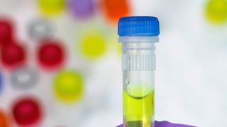 Der „Reach Dossier Improvement Action Plan“ des europäischen Chemie-Dachverbands Cefic beschäftigt sich mit der Qualität der Reach Registrierungsdossiers. (gemeinfrei)