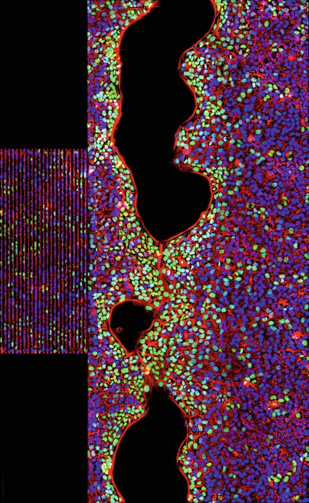 Dreifarbenaufnahme stimulierter Zellen auf einem SAW-Chip. Rot: Phasenkontrastbild der Zellen, blau: Zellkerne, grün: Zellkerne von Zellen, die sich während der Schallbehandlung geteilt haben.