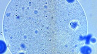 Eine Mikrokapsel ist mit rund 20 000 probiotischen Keimen gefüllt, die erst im Darm die schützende Hülle verlassen.  (Bild: Thomas Heidebach/TUM)