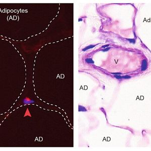 Nachweis von Eosinophilen in menschlichem Bauchfett mittels zwei unterschiedlicher Färbungen. Die Eosinophile sind mit einer Pfeilspitze markiert. AD: Adipozyten (Fettzelle), V: Blutgefäß. (Bild:  © DBMR, Universität Bern, D. Brigger)