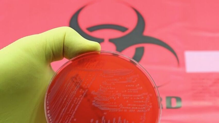 15 Pathogene stehen auf der Beobachtungsliste der WHO für Erreger mit dringendem Forschungsbedarf. (Bild: TopMicrobialStock - stock.adobe.com)