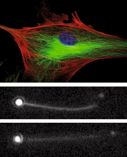 Abb. 3: Proben, z.B. ganze Zellen (links, BPAE Zelle; Fluo Cells Slide #2) oder auch einzelne Moleküle (rechts, Alexa 555 markierte Rad51 Proteine) lassen sich in Echtzeit mit Nanometer-Präzision beobachten. (Bild oben: Molecular Probes, Bild unten: M. Modesti Lab, CNRS Marseilles (Archiv: Vogel Business Media)