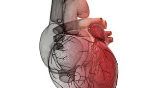 Ist die Arterie verstopft ist Gefahr im Verzug: Forschende der Universität Tübingen haben einen körpereigenen Mechanismus entdeckt, der gefährliche Thrombosen hemmt, die zu Schlaganfall und Herzinfarkt führen können. (Symbolbild)  (©LaCozza - stock.adobe.com)