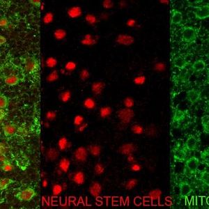 Mitochondrien und Mikrozephalie

Forscher des Institute for Research in Biomedicine in Barcelona haben den zellulären Mechanismus identifiziert, der erklärt, warum bestimmte Fehler bei der Chromosomenteilung zu Mikrozephalie führen können – einem Zustand, bei dem sich das Gehirn zu einer unterdurchschnittlichen Größe entwickelt. Die Studie konzentriert sich auf eine seltene Krankheit namens Mosaic Variegated Aneuploidy MVA.
 
Um den Ursprung dieser Symptome zu untersuchen, nutzte das Team die Fruchtfliege als Modell. Bei Fliegen wie beim Menschen entsteht das Gehirn aus neuralen Stammzellen, die sich teilen und Neuronen sowie Gliazellen bilden. Durch die Elimination von Genen, die für die korrekte Verteilung der Chromosomen in diesen Stammzellen verantwortlich sind, gelang es den Forschern, die bei Patienten beobachtete Mikrozephalie zu reproduzieren.
Im Bild zu sehen sind neurale Stammzellen (in Rot) und ihr mitochondriales Netzwerk (in Grün). Die Studie deckt auf: Defekte Mitochondrien, die nicht entsorgt werden, stören die Zellteilung und können Mikrozephalie verursachen


Hier gehts zur Originalmeldung
Wissenschaftsbild des Tages vom 2.4.2026
 (Bild: IRB Barcelona)