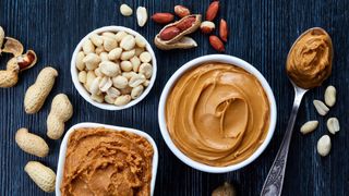 Erdnüsse gehören zu den wenigen Lebensmitteln, die reich an so genannten VLCSFA (Very Long Chain Saturated Fatty Acids) sind und zusammen mit ihrem hohen Gehalt an einfach ungesättigten Fettsäuren ein einzigartiges und unverwechselbares Fettsäureprofil aufweisen. (Bild: © baibaz – stock.adobe.com)