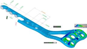 Intelligente Softwareverfahren in der Messsoftware Win Werth ermöglichen beispielsweise fertigungsbegleitende Implantatmessungen mit minimalen Zykluszeiten. (Bild: Werth Messtechnik)