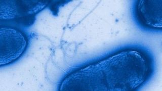 Pseudomonas aeruginosa – ein weitverbreiteter Krankenhauskeim (Bild: Helmholtz-Zentrum für Infektionsforschung)