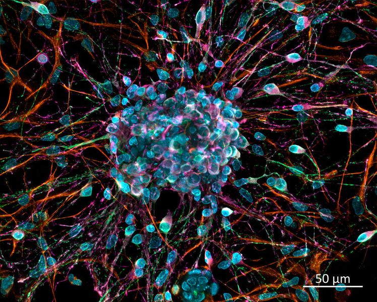 Primäre neuronale Zellen in Kultur. Dekonvolvierte Z-Stapel Projektion mit GPU-basierter Dekonvolution. Antikörper-Färbung von Klasse III beta-Tubulin (Cy2), Nestin (Cy3) und DCX (Cy5). Kerne mit DAPI-Färbung. Probe bereitgestellt von H. Braun, LSM Bioanalytik GmbH, Magdeburg, Germany. (Zeiss)