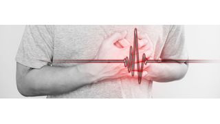 Der Herzinfakt oder auch Myokardinfarkt ist die häufigste Todesursache weltweit. (©SasinParaksa - stock.adobe.com)