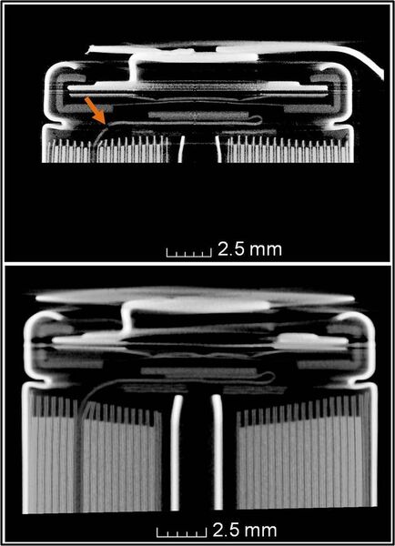 Vertikale Computertomograph-Schnittebene durch den elektrisch ausgefallenen Akkumulator (oben) und zum Vergleich durch einen intakten Akkumulator (unten). (Wenzel)