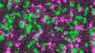 Rezeptoren (grün) und G-Proteine (magenta) wandern über die Oberfläche einer lebenden Zelle, bevor sie an sogenannten „Hot Spots“ auf der Zellmembran aufeinander treffen. (AG Calebiro)
