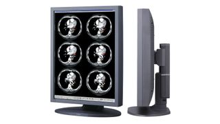 Der Monitor CCL214 von Totoku soll Röntgenbilder immer in der gleichen guten Qualität darstellen (JVCKenwood)