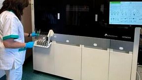 My Genius Pro installed at a leading European transplant center supporting routine infectious disease testing. (Source: Elitech Group)