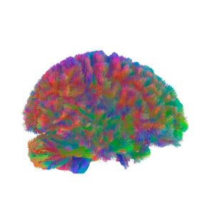 A representative MRI tractography image of the first era of the human brain. This image is representative of the general pattern seen across the brains in the study during the fourth era of neural wiring, the “early aging” phase.(Source:  Dr Alexa Mousley/ University of Cambridge)