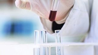 Wie beurteilen privatwirtschaftliche Laboratorien den Akkreditierungsaufwand? Eine Dezember-Umfrage unter den VUP-Mitgliedsunternehmen zeigt deren Einschätzung (Symbolbild). (gemeinfrei)