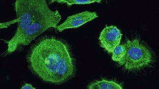 Diese Immunzellen exprimieren den HCA3-Rezeptor, der nur bei Menschanaffen und Menschen vorkommt. Kern und Cytoskelett sind gefärbt. (Claudia Stäubert)