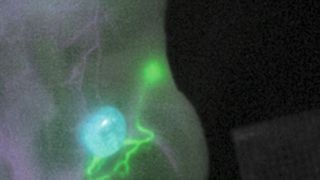 Die neue Fluoreszenbildgebung macht Tumor (blau), Lymphgefäße (grün) und Blutgefäße (magenta) sichtbar. (Dr. Mara Saccomano, Helmholtz Munich)