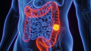 0123531336v2 (Bild: © Sebastian Kaulitzki - stock.adobe.com)