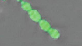 Unscheinbar, aber gefährlich: Das Bakterium Streptococcus pneumoniae kann und Lungen- und Hirnhautentzündung auslösen. (© MPI für Kolloid- und Grenzflächenforschung)