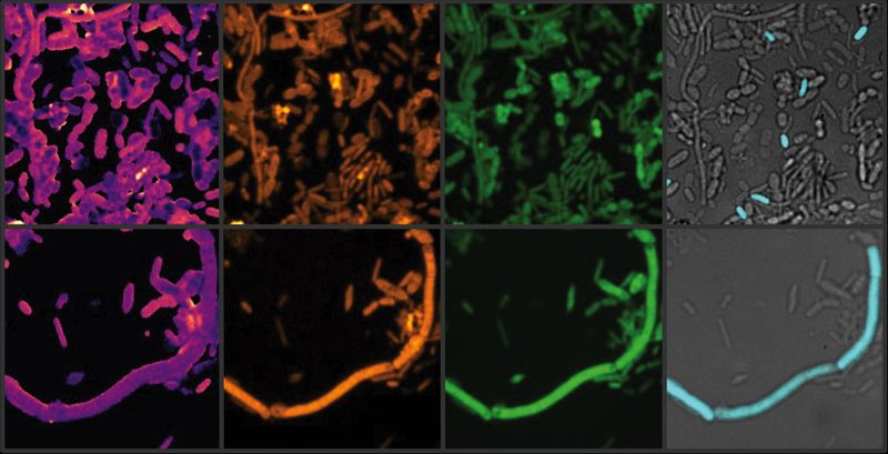 Medikamente fördern Eisenmangel im Darmmikrobiom Ein Parkinson-Medikament verursacht Eisenmangel im Darm und fördert so das Wachstum von E. coli. Diese Bakterien besitzen ein effizientes System zur Eisenaufnahme, was zu einem Ungleichgewicht im Darm führt. Aus dem Ungleichgewicht resultierend, werden pathogene Mikroben begünstigt. Diese Entdeckung von Forschern der Universität Wien hilft dabei, Arzneimittel-Mikrobiom-Wechselwirkungen besser zu erforschen. Um die Nebenwirkungen solcher Medikamente zu mildern, soll die Eisenverfügbarkeit im Darm gezielt unterstützt werden.  Das Bild zeigt aktive Darmmikroben mithilfe chemischer Bildgebung. Die Aktivität der Mikroben wird anhand der Menge der C-D-Bindungen detektiert. Nach einer kurzen Inkubation mit schwerem Wasser, Kulturmedium und einem Medikament werden verschiedene chemische Bindungen (hier C-D und C-H) in der Stuhlprobe in Gelb und Grün dargestellt, ihr Verhältnis in Gelb-Violett (links). Ausgewählte Mikroben werden im gleichen Bildbereich mit fluoreszenzmarkierten Oligonukleotid-Sonden in Cyan detektiert. Hier gehts zur Originalmeldung Wissenschaftsbild des Tages vom 5.12.2024  (Bild: Xiaowei Ge (Boston University))