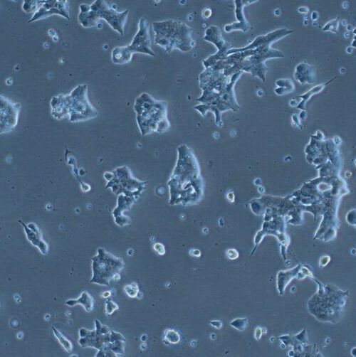Insulin-producing cells of the mouse in cell culture. Insulin-producing cells of the mouse in cell culture.