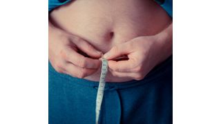 Obesity — still stigmatised in our society — always generates important changes in physiology and metabolism. (Source: Public Domain)