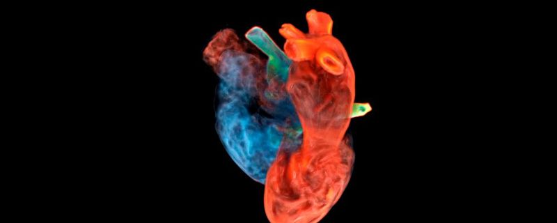 Der digitale Herzzwilling von Siemens Healthineers.(Bild:  Siemens Healthineers)