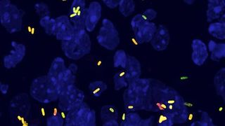 Milzgewebe einer infizierten Maus mit schnell (grün) und langsam (orange) wachsenden Salmonellen (blau: Kerne der Mauszellen). (Bild: Universität Basel, Biozentrum)