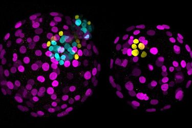 Genediting in der Embryonalentwicklung


Forschende der University of Cambridge haben erstmals eine Genediting-Technik eingesetzt, um die Funktion eines einzelnen Gens in menschlichen Embryonen zu untersuchen. Die Methode namens Base-Editing ist eine präzisere Weiterentwicklung der bekannten CRISPR/Cas9-Technik. Sie kann ein einzelnes Nukleotid-Basenpaar innerhalb eines menschlichen Genoms von rund drei Milliarden Basenpaaren verändern.
Ein besseres Verständnis von der Funktion einzelner Gene könnte dazu beitragen, die Erfolgschancen der In-vitro-Fertilisation zu verbessern.

Das Bild zeigt: Links ein normaler Embryo (magentafarbene Zellen entwickeln sich zur Plazenta, gelbe zum Dottersack und türkise zum Epiblasten, aus dem später der Körper entsteht) und rechts ein Embryo, bei dem das sogenannte NANOG-Gen durch Genediting blockiert wurde (türkise Zellen fehlen vollständig – der Epiblast konnte sich nicht entwickeln)


Hier geht‘s zur Originalmeldung
Wissenschaftsbild des Tages vom 7.7.2026
 (Bild: Loke Centre for Trophoblast Research, University of Cambridge)