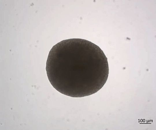 Ein Zellaggregat bzw. ein so genanntes Sphäroid, welches als Building Block für kultiviertes Fleisch verwendet werden kann. (Bild:  Hochschule Reutlingen)