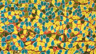 Querschnitt eines Muskels: Eine reduzierte Kalorienzufuhr erhöht den Anteil an altersresistenten Muskelfasern (gelb und blau). (Universität Basel, Biozentrum)