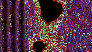 Dreifarbenaufnahme stimulierter Zellen auf einem SAW-Chip. Rot: Phasenkontrastbild der Zellen, blau: Zellkerne, grün: Zellkerne von Zellen, die sich während der Schallbehandlung geteilt haben. (Baumgartner, Westerhausen / Universität Augsburg)