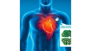 Dank der Leiterplattenkompetenz ist AT&S in der Lage, kompakte Herzschrittmacher mit langer Batterielebensdauer zu entwickeln. (AT&S)
