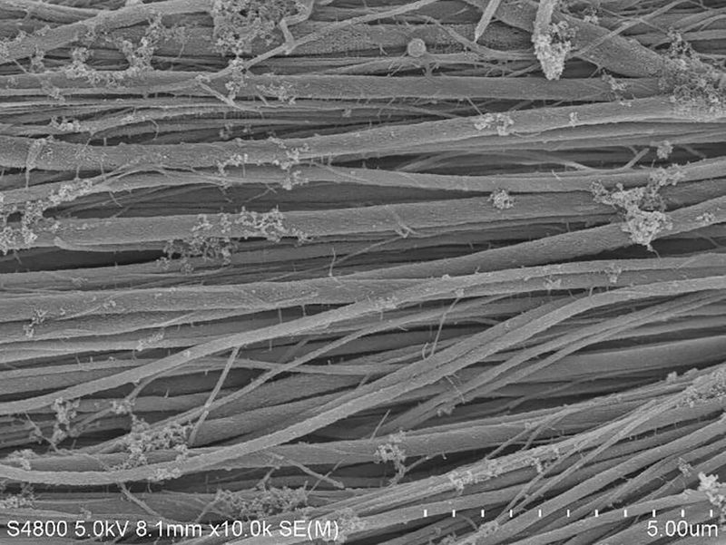 Unter dem Elektronenmikroskop: Kollagenfaserbündel nach der Mineralisation mit (dem Knochenmineral) Kalziumphosphat