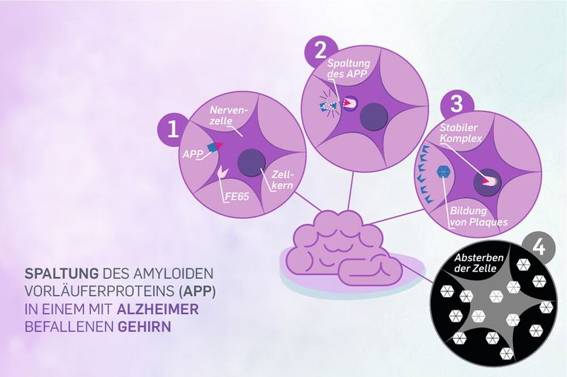 So läuft die APP-Spaltung in einem mit Alzheimer befallenen Gehirn ab. Die nicht abgebauten Proteinreste führen zum Absterben der Zelle. (Bild: Agentur der RUB)