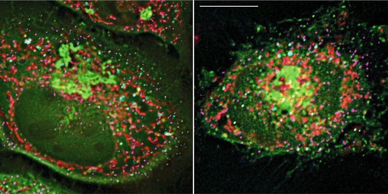 Zwei fluoreszenmikroskopische Aufnahmen: Das Protein Arf1 (grün) sorgt an der Kontaktstelle zwischen Mitochondrium (rot) und Lipidtröpfchen (türkis) dafür, dass Lipide in die Mitochondrien geschleust werden, wo sie in den Energiespender ATP umgewandelt werden.