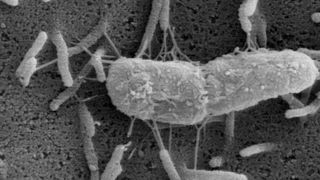 Enterobacteriaceen mit Resistenz gegen bestimmte Antibiotika sind zunehmend ein Problem bei Krankenhaus-Infektionen. (Bild: Institut für Medizinische Mikrobiologie, JLU Gießen)