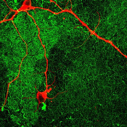 Fluorescent image of a human neuron (red) growing on the coating with fast-moving molecules (green) for 60 days. Fluorescent image of a human neuron (red) growing on the coating with fast-moving molecules (green) for 60 days.