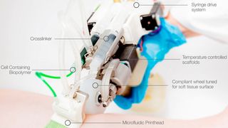 Der Gesamtsieger der 3D Pioneer Challenge 2020 ist der „Rever Tome Handheld Bioprinter“ der
Universität Toronto. Das Projekt von Richard Cheng, Gertraud Eylert, Jean-Michel Gariepy,
Sijin He, Yizhou Gao, Hasan Ahmad, Marc Jeschke und Axel Guenther ist ein
mobiles chirurgisches Instrument, das Hautschichten bei großen Verbrennungen gleichmäßig
abgibt, um die Wundheilung zu verbessern. Das Team um Richard Cheng wurde mit dem Preisgeld in Höhe von 10.000 € prämiert. (Messe)