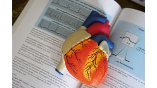 Bluthochdruck und Übergewicht gehen oft Hand in Hand. Eine neue Studie hat nun einige der komplexen biologischen Mechanimsen untersucht (Symbolbild). (gemeinfrei, Robina Weermeijer)