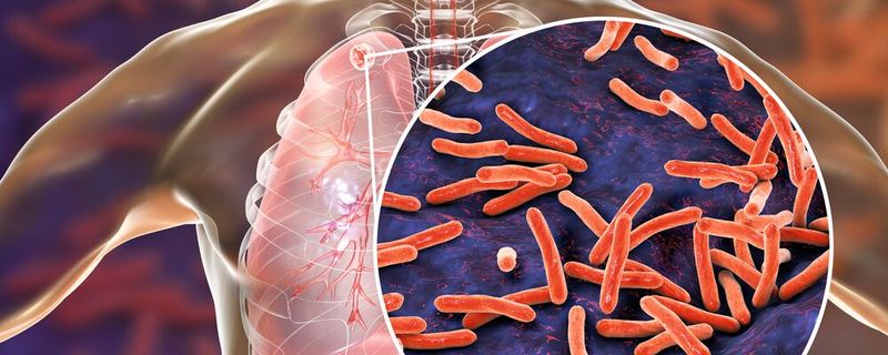 Einige bakterielle Krankheitserreger wie Mycobacterium tuberculosis stellen sich tot, um Antibiotika zu umgehen. Ein neuer Test beobachtet sie genau – und hilft dabei, Medikamente auszuwählen, die ihre Aufgabe erfüllen. (Symbolbild)(Bild: ©  Dr_Microbe - stock.adobe.com)