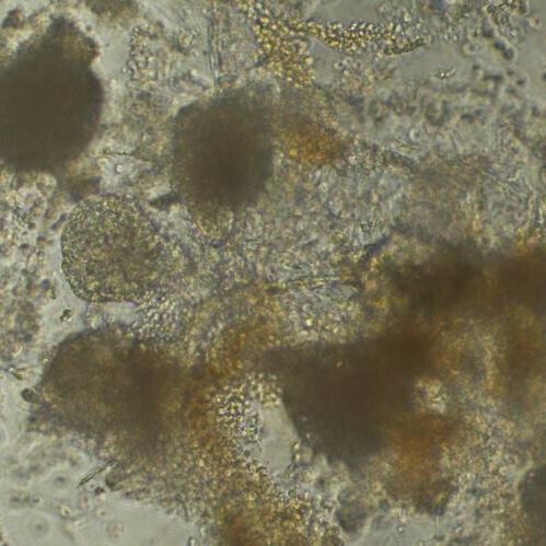 Analysing samples such as heart cells from hundreds of donors (pictured) has the potential to reveal new insights into disease. Analysing samples such as heart cells from hundreds of donors (pictured) has the potential to reveal new insights into disease.