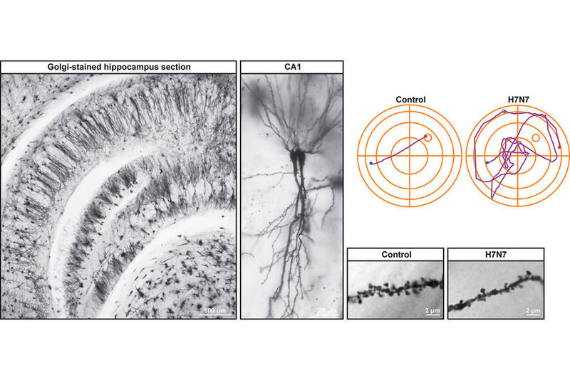 „Knubbel“ zählen: Über die kleinen Pünktchen auf dem Mikroskopbild können die Forscher die Zahl der Synpasen im Hippocampus ermitteln. Der Hippocampus ist die für das Lernen und Erinnern zuständige Gehirnregion. (© TU Braunschweig/Martin Korte)
