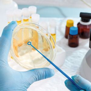 Abb.2: Gerade die Planung des Vorrats von Verbrauchsmaterialien ist für den reibungslosen Ablauf in einem Labor enorm wichtig.