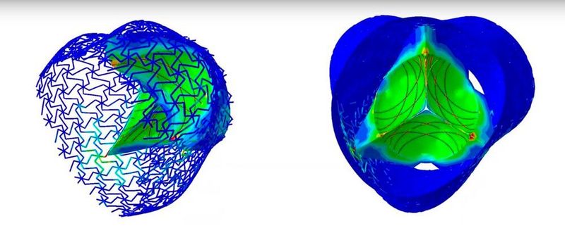 Die Silikon-Herzklappe ist maßgeschneidert, weil die Forscher zuerst die individuelle Form und Größe der undichten Herzklappe mittels Computertomographie oder Magnetresonanztomografie bestimmen.  (ETH Zürich)