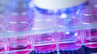 Humane Hepatoma-Zellen, die mit Hepatitis-E-Viren infiziert wurden, werden in der Immunfluoreszenz analysiert. ( © Damian Gorczany, Ruhr-Universität Bochum)