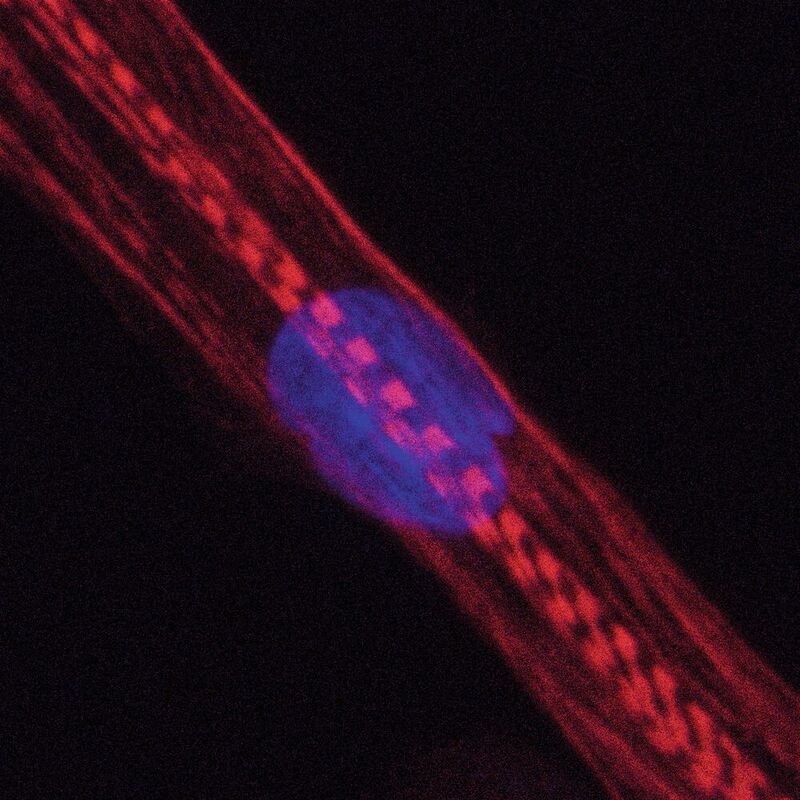 Humane Muskelzelle. Bei Menschen, die Statine nehmen, war u.a. die Produktion von Myosinen gestört. Diese Proteine sind im Bild rot angefärbt, der Zellkern blau. Die Querstreifen zeigen, dass die Zelle sich in eine reife Muskelfaser entwickelt.