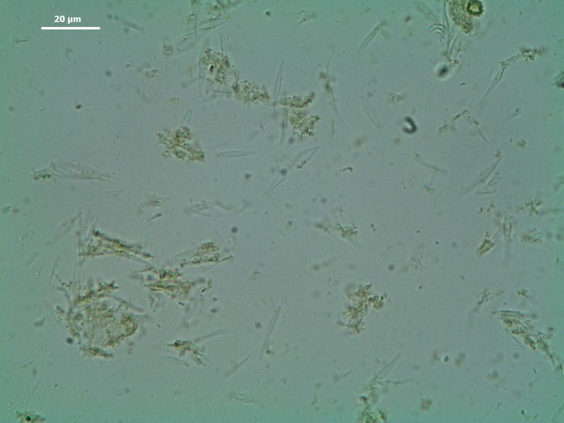 Abb. 1d: Zellen der Mikroalge Phaeodactylum tricornutum nach dem Aufschluss mittels Schwingmühle MM 400 und Falcontube-Adapter, 3 x 60 Sekunden bei 30 Hz (Bild: Retsch)