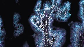 Querschnitt durch Darmfalten im Vorderdarm von Neolamprologus brevis. Angefärbt sind zwei Gene, die besonders im Darm räuberischer Arten eine Rolle spielen. Türkis zeigt Aktivität eines Gens für die Verarbeitung von Eiweissen, Violett diejenige für ein Gen im Kontext des Energiestoffwechsels. (Bild: Patrick Tschopp, Universität Basel)
